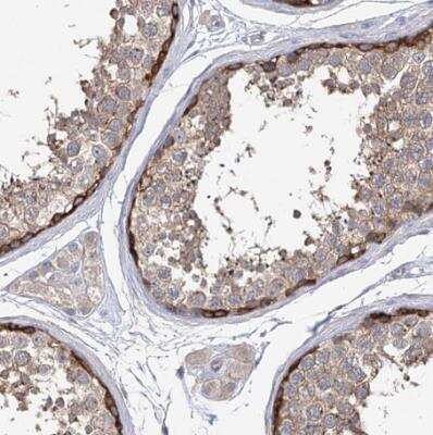 Immunohistochemistry-Paraffin: EPB41L5 Antibody [NBP2-38354]
