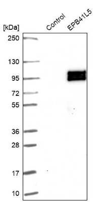 Western Blot: EPB41L5 Antibody [NBP2-30920]