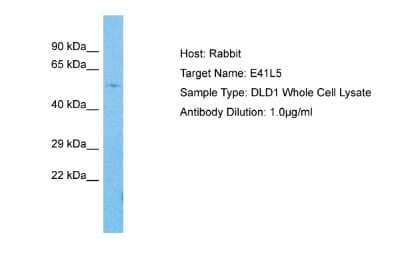 Western Blot: EPB41L5 Antibody [NBP2-87368]