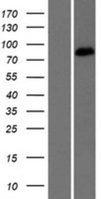 Western Blot: EPB41L5 Overexpression Lysate [NBP2-10260]