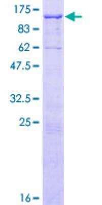 SDS-PAGE: Recombinant Human EPB41L5 GST (N-Term) Protein [H00057669-P01]