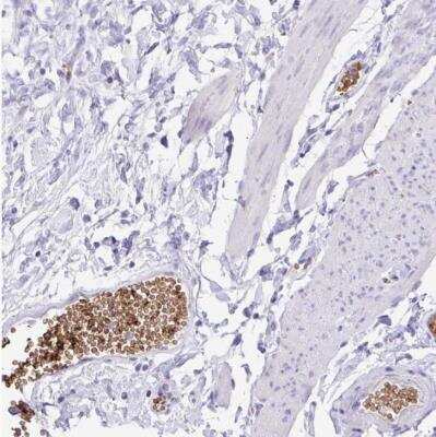 Immunohistochemistry-Paraffin: EPB42 Antibody [NBP1-82762]