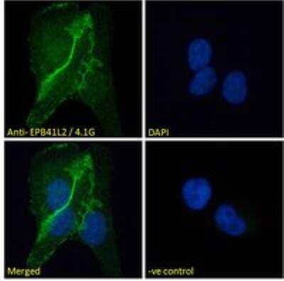 Immunocytochemistry/ Immunofluorescence: EPB4IL2 Antibody [NBP1-06034]