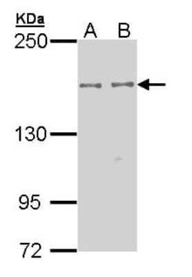 Western Blot: EPB4IL2 Antibody [NBP1-33426]