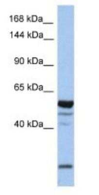 Western Blot: EPB4IL2 Antibody [NBP1-56763]