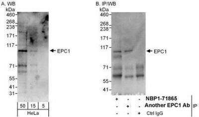 Western Blot: EPC1 Antibody [NBP1-71865]