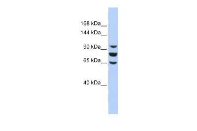 Western Blot: EPC1 Antibody [NBP2-86628]