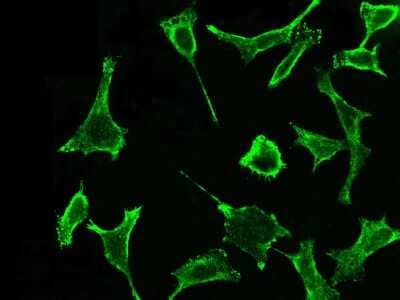 Immunocytochemistry/ Immunofluorescence: EPCR Antibody (041) [NBP2-90204]