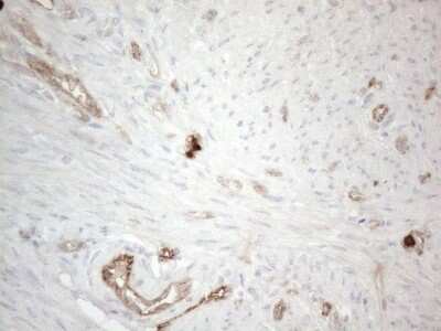 Immunohistochemistry: EPCR Antibody (OTI12H5) [NBP2-45395]