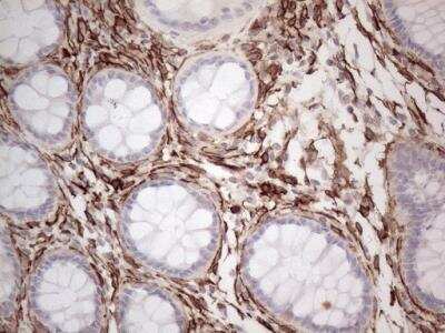 Immunohistochemistry-Paraffin: EPCR Antibody (OTI12H5) [NBP2-45395]