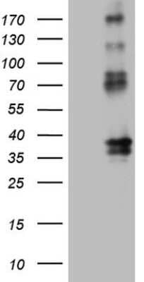 Western Blot: EPCR Antibody (OTI12H5) [NBP2-45395]