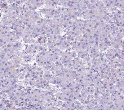 Immunohistochemistry-Paraffin: EPCR Antibody [NBP1-88168]