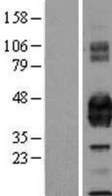 Western Blot: EPCR Overexpression Lysate [NBL1-14804]