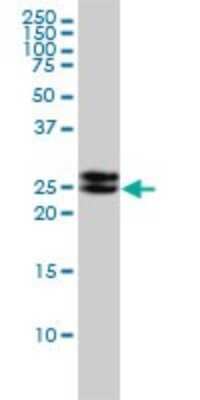 Western Blot: EPDR1 Antibody (1C1) [H00054749-M01]