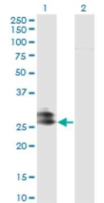 Western Blot: EPDR1 Antibody (1C1) [H00054749-M01]
