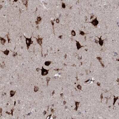 Immunohistochemistry-Paraffin: EPDR1 Antibody [NBP3-17014]