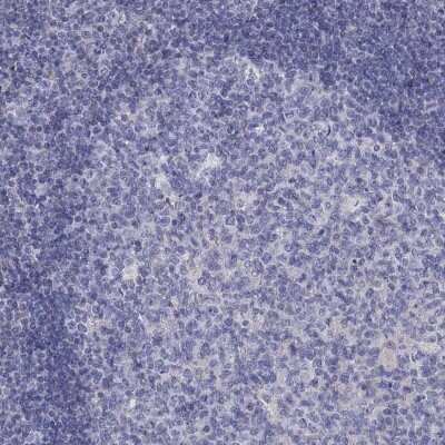 Immunohistochemistry-Paraffin: EPDR1 Antibody [NBP3-17014]