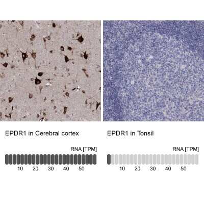 Immunohistochemistry-Paraffin: EPDR1 Antibody [NBP3-17014]