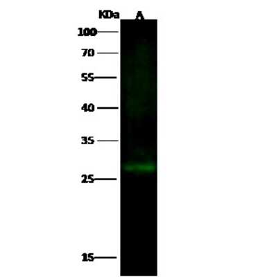 Western Blot: EPDR1 Antibody [NBP3-00177]