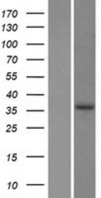 Western Blot: EPDR1 Overexpression Lysate [NBP2-06961]