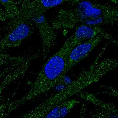 Immunocytochemistry/ Immunofluorescence: EPG5 Antibody [NBP1-83970]