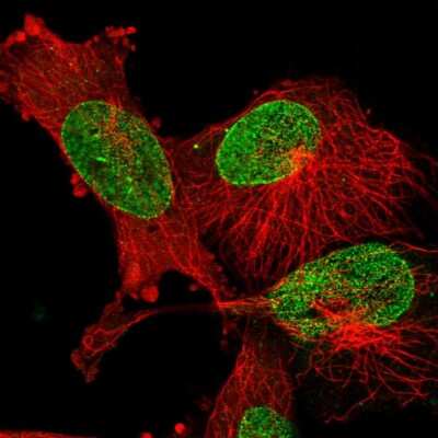 Immunocytochemistry/ Immunofluorescence: EPGN Antibody [NBP2-58295]