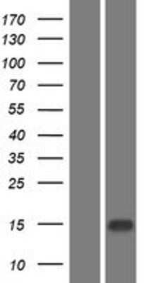 Western Blot: EPGN Overexpression Lysate [NBP2-08721]