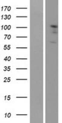 Western Blot: EphA2 Overexpression Lysate [NBP2-10583]