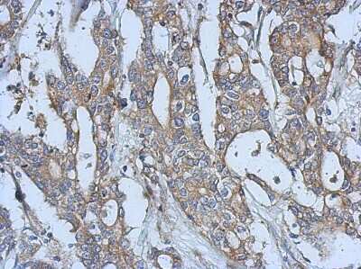 Immunohistochemistry-Paraffin: EphA3 Antibody [NBP2-16346]