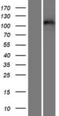 Western Blot: EphA3 Overexpression Lysate [NBP2-10482]