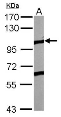 Western Blot: EphA4 Antibody [NBP2-16347]
