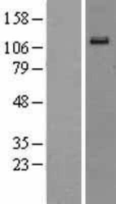 Western Blot: EphA6 Overexpression Lysate [NBL1-10291]