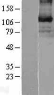 Western Blot: EphB3 Overexpression Lysate [NBL1-10292]