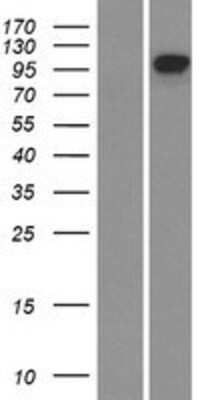 Western Blot: EphB4 Overexpression Lysate [NBL1-10293]