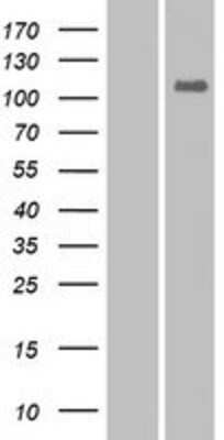 Western Blot: EphA10 Overexpression Lysate [NBP2-08282]