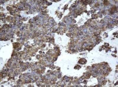 Immunohistochemistry: EPHX1 Antibody (OTI3F10) [NBP2-45478]