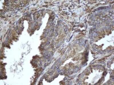 Immunohistochemistry: EPHX1 Antibody (OTI3F10) [NBP2-45478]