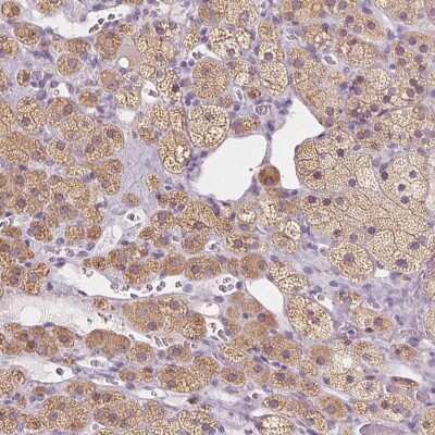 Immunohistochemistry-Paraffin: EPHX1 Antibody [NBP1-83969]