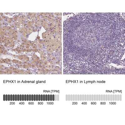 Immunohistochemistry-Paraffin: EPHX1 Antibody [NBP1-83969]