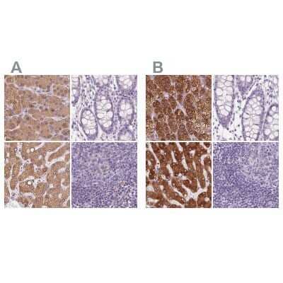 Immunohistochemistry-Paraffin: EPHX1 Antibody [NBP1-83969]