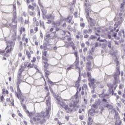 Immunohistochemistry-Paraffin: EPHX1 Antibody [NBP1-83969]