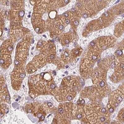 Immunohistochemistry-Paraffin: EPHX1 Antibody [NBP1-83969]