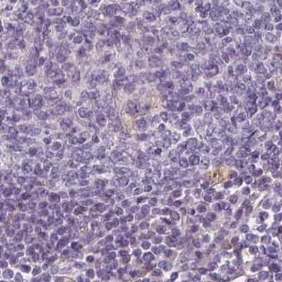 Immunohistochemistry-Paraffin: EPHX1 Antibody [NBP1-83969]