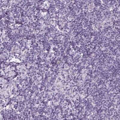 Immunohistochemistry-Paraffin: EPHX1 Antibody [NBP2-38594]