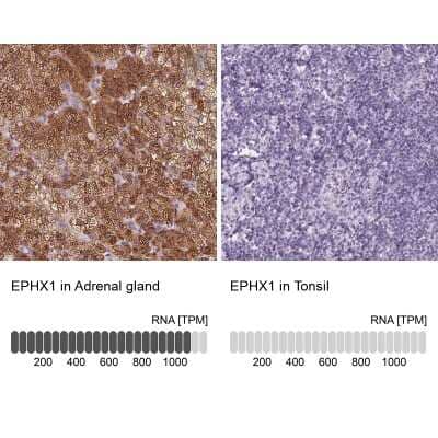 Immunohistochemistry-Paraffin: EPHX1 Antibody [NBP2-38594]