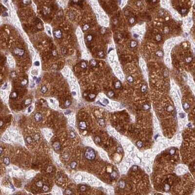 Immunohistochemistry-Paraffin: EPHX1 Antibody [NBP2-38594]