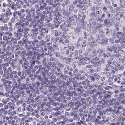 Immunohistochemistry-Paraffin: EPHX1 Antibody [NBP2-38594]