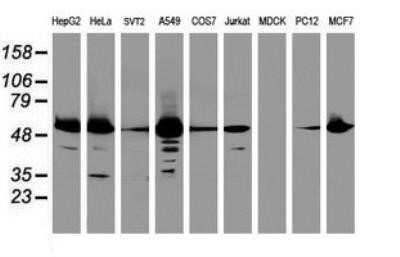Western Blot: EPHX1 Antibody (OTI3F10)Azide and BSA Free [NBP2-70646]