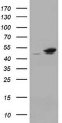 Western Blot: EPHX1 Antibody (OTI3F10)Azide and BSA Free [NBP2-70646]