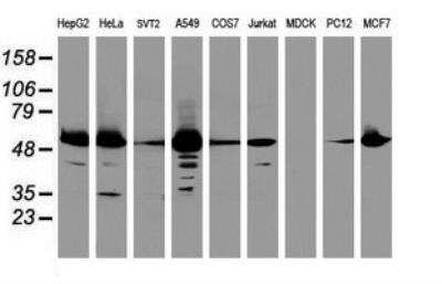 Western Blot: EPHX1 Antibody (OTI3F10) [NBP2-45478]